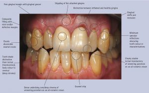 fotografía clínica odontología