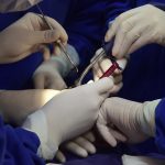 Implantologia avanzada curso Implantes Cigomaticos
