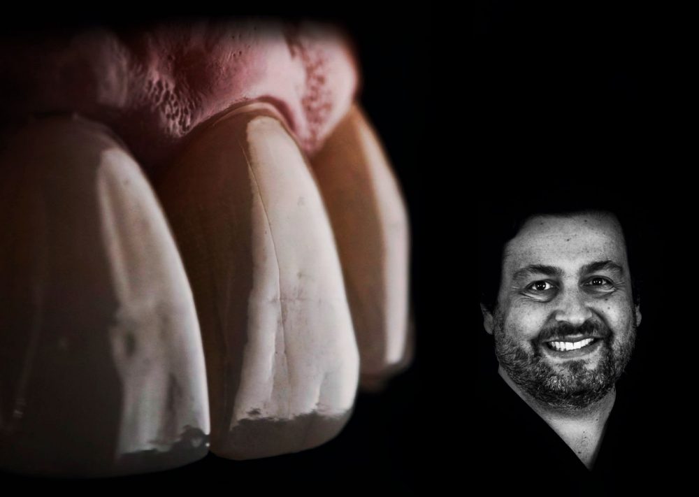 implantología estética darcio fonseca curso dental innovation socket shield
