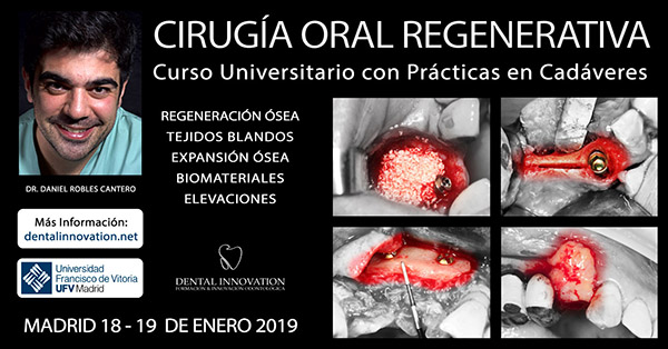 Curso Universitario En Cirugía Oral Avanzada Regenerativa - 