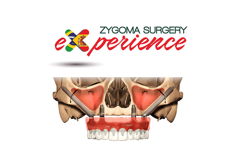 zygoma surgery experience dental innovation implantes zigomaticos curso clinico practico